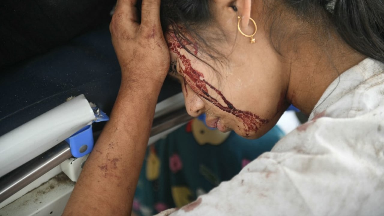 Se ve sangre en el rostro de una sobreviviente de un terremoto mientras descansa en un hospital en Naypyidaw el 28 de marzo de 2025, después de un terremoto en el centro de Myanmar. Un poderoso terremoto sacudió el centro de Myanmar el 28 de marzo, deformando carreteras en la capital Naypyidaw, dañando edificios y obligando a la gente a huir a las calles en la vecina Tailandia. (Foto de Sai Aung PRINCIPAL / AFP)