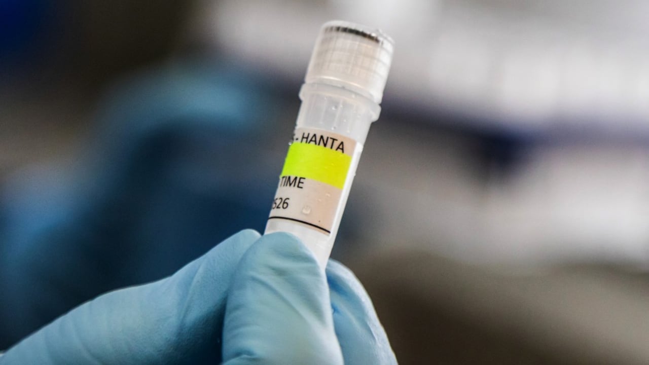 Argentina ha registrado un aumento en los casos de hantavirus, pero no un brote.