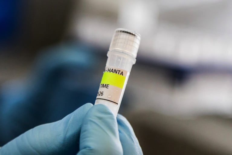 Argentina ha registrado un aumento en los casos de hantavirus, pero no un brote.