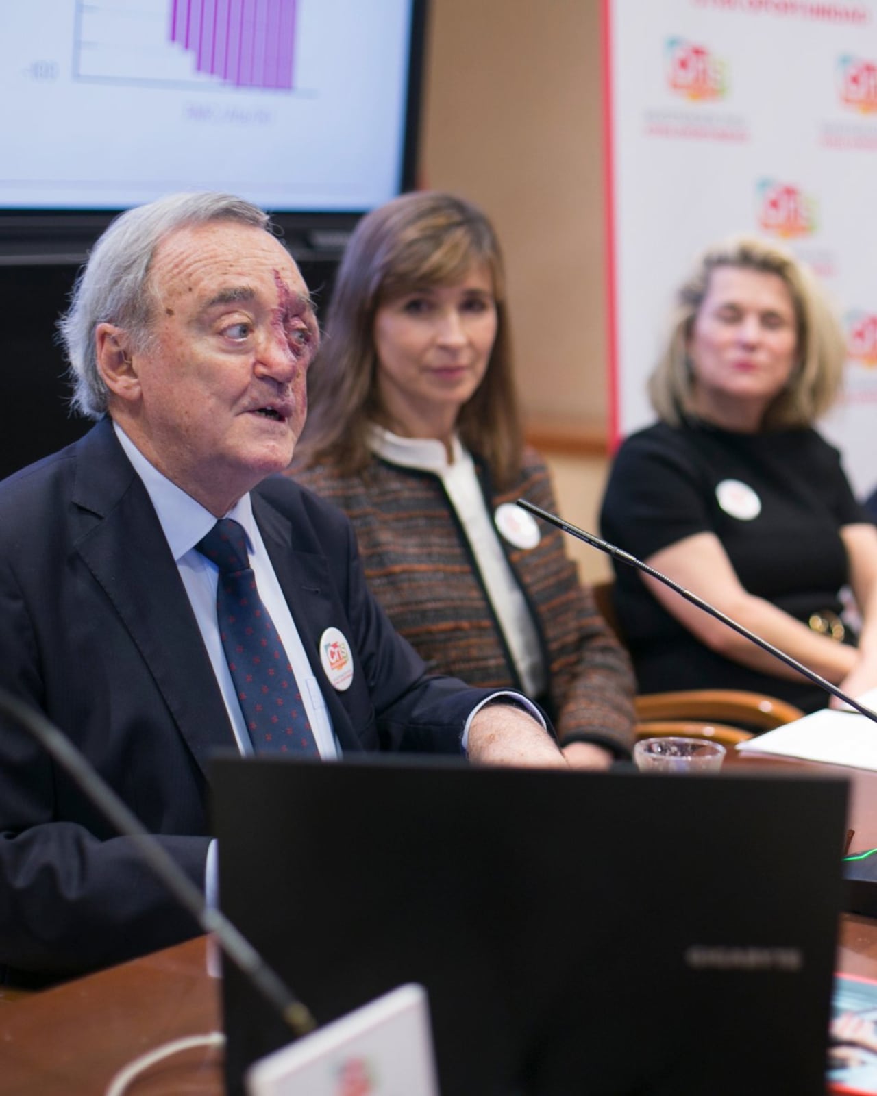 El grupo, dirigido por el oncólogo Mariano Barbacid, consiguió erradicar el tipo más frecuente de cáncer pancreático.