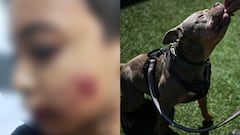 El menor de edad tuvo graves heridas en el rostro, brazos y espalda luego de ser atacado por un perro de raza American Bully que no tenía bozal. (Imagen del perro de referencia)