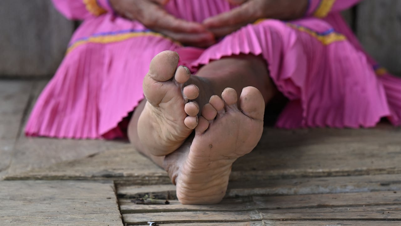 MUTILACIÓN GENITAL MUJERES INDIGENAS