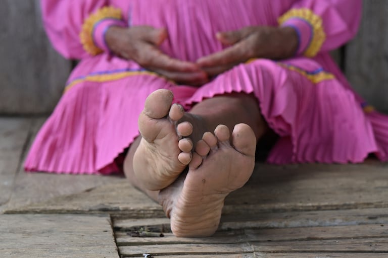 MUTILACIÓN GENITAL MUJERES INDIGENAS