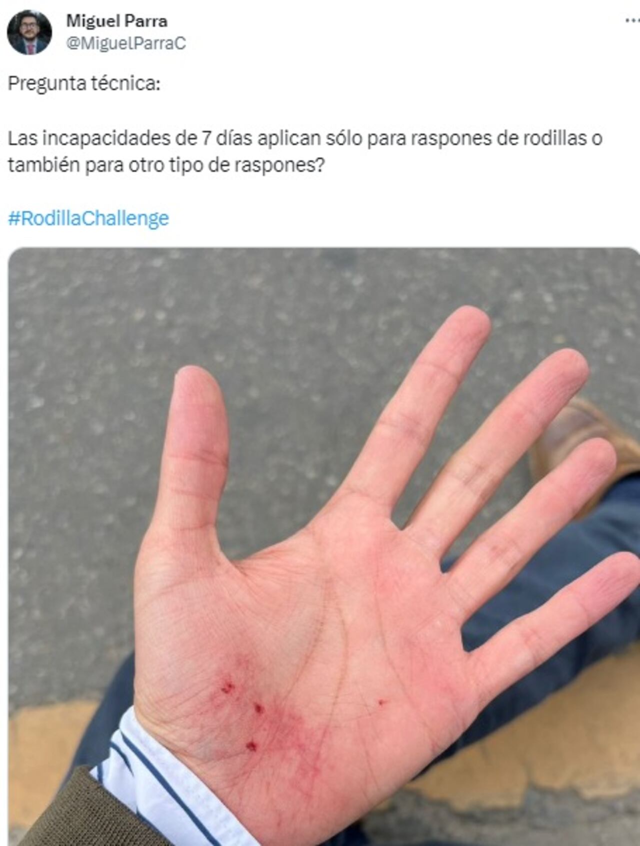 Rodilla Challenge