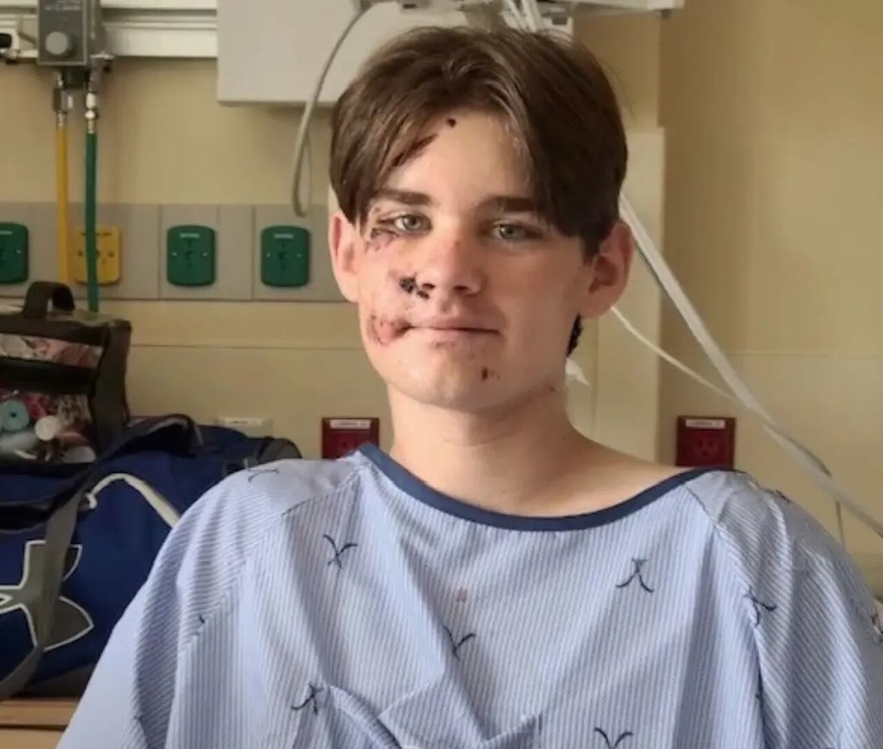 El joven sufrió varias heridas tras caer del Gran Cañón en Estados Unidos.