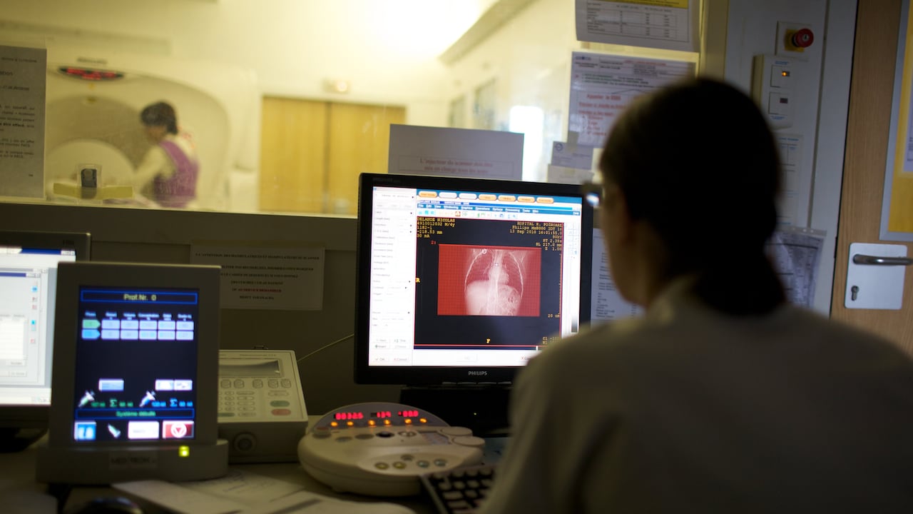 El mieloma múltiple es un cáncer de la sangre que afecta a un tipo de glóbulos blancos llamados células plasmáticas o plasmocitos