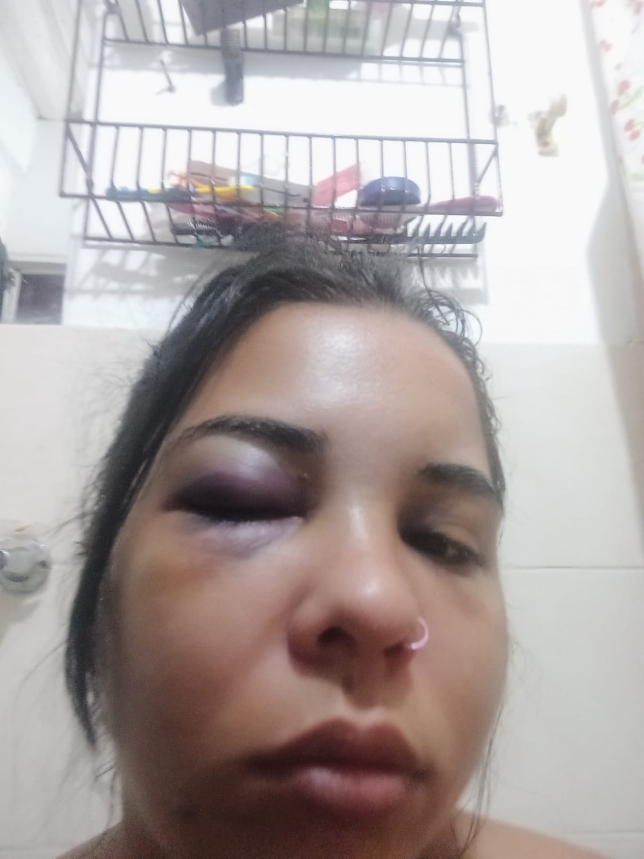 La mujer recibió lesiones en su rostro y, además, el sujeto hurtó sus pertenencias.