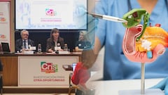 Un avance del CNIO abre esperanza tras erradicar adenocarcinoma ductal en modelos animales.