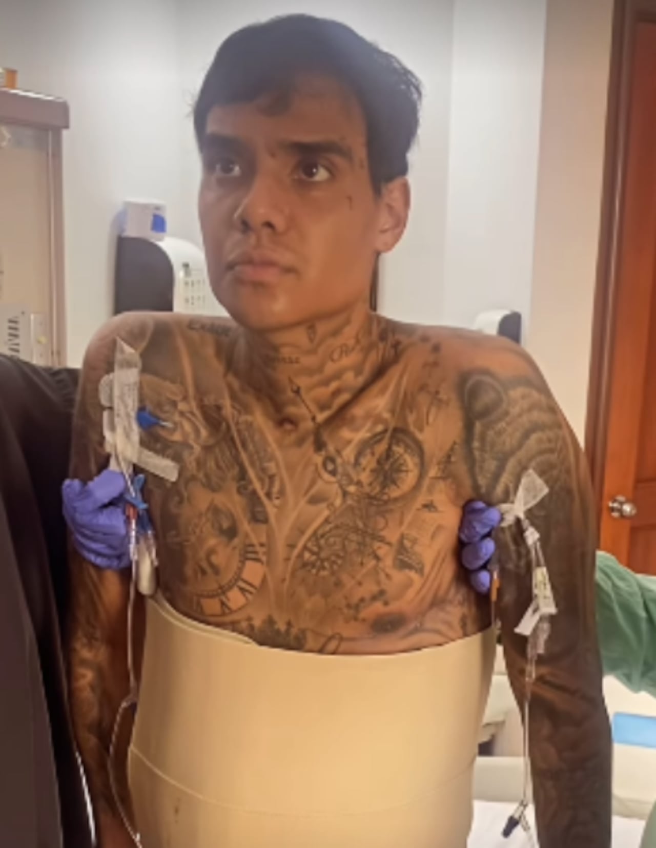 El artista requiere asistencia para ponerse de pie.