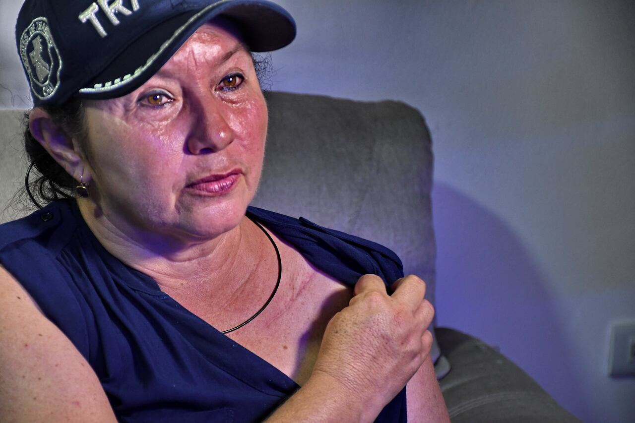 Cali: Agentes de tránsito agredidos, Rocío Mendoza, agredida el pasado 8 de agosto del 2024. foto: José L Guzmán. El País