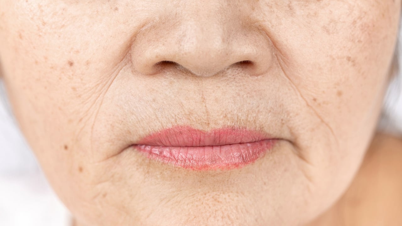 Arrugas en los labios