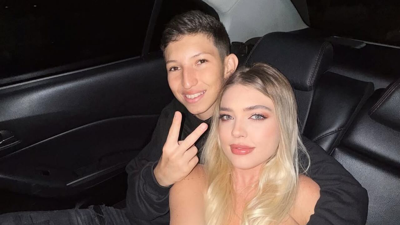 Exnovio de Yana Karpova quedó irreconocible tras luego de dos cirugías: “Parece Justin Bieber”.