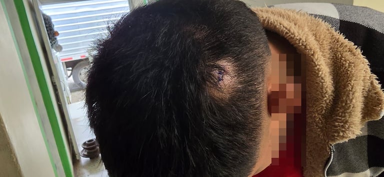 "Uno de los delincuentes se apiadó de mi hermano y su ayudante, por eso no los asesinó, esperó que los demás sujetos se fueran para así no matarlos", relataron los familiares de una de las víctimas.