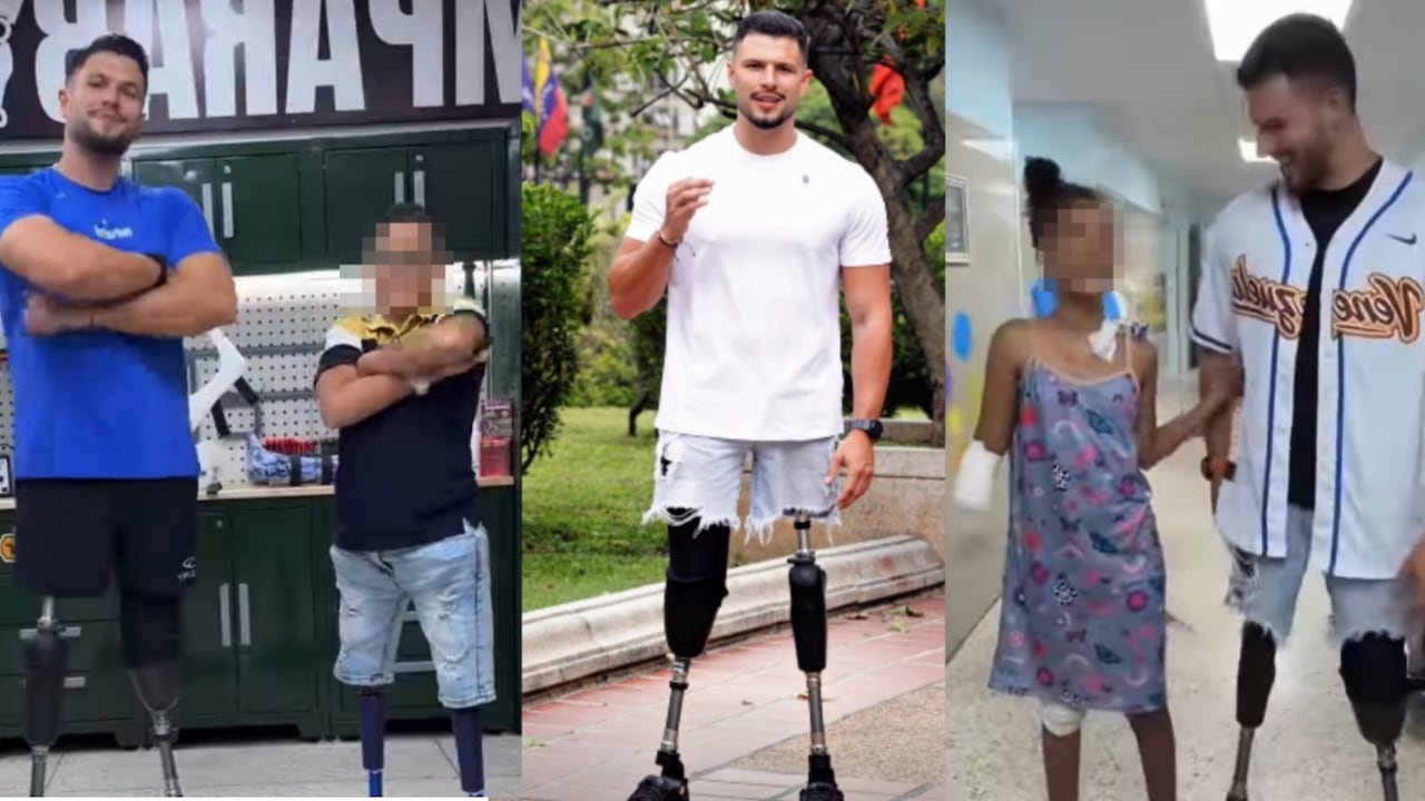 Juan Pablo Dos Santos impulsa una iniciativa para facilitar el acceso a prótesis y rehabilitación de sobrevivientes amputados tras los terremotos en Venezuela.