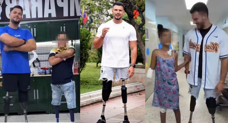 Juan Pablo Dos Santos impulsa una iniciativa para facilitar el acceso a prótesis y rehabilitación de sobrevivientes amputados tras los terremotos en Venezuela.