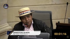 Representante a la Cámara Ermes Evelio Pete