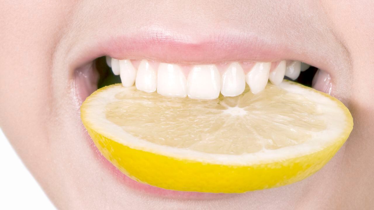 El limón, aunque saludable, puede causar erosión del esmalte dental debido a su alta acidez